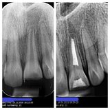 Clever Dental - Clinica Stomatologica